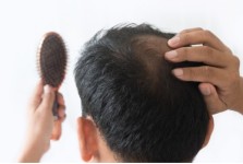 HAIR LOSS