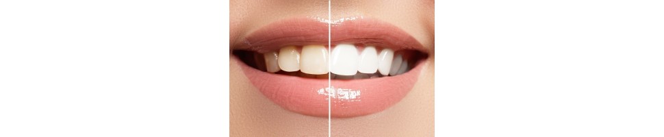TEETH WHITENING
