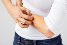 ITCH & RASH