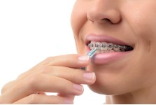 ORTHODONTIC CARE