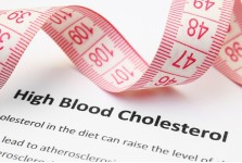 CHOLESTEROL
