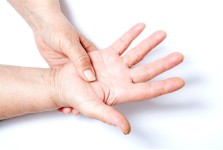 FIBROMYALGIA